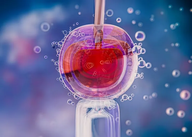 You are currently viewing Factors Affecting the Success of IUI
